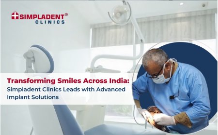 Transforming Smiles Across India: Simpladent Clinics Leads with Advanced Implant Solutions