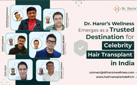 Dr. Haror’s Wellness Emerges as a Trusted Destination for Celebrity Hair Transplant in India